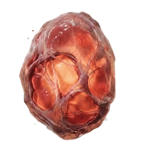 Void Embryo Sac